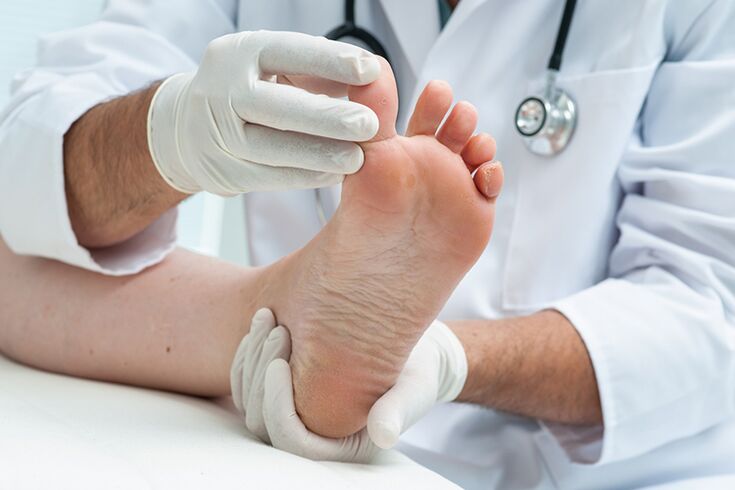 medicul dermatolog examinează picioarele pacientului