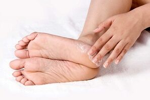 tratamentul cremei fungice a pielii picioarelor